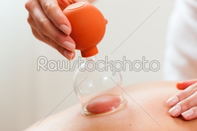 Patient at the physiotherapy - cupping