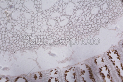Agaricus section under the microscope