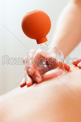 Patient at the physiotherapy - cupping